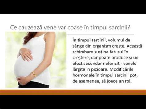 varice uretrale în timpul sarcinii